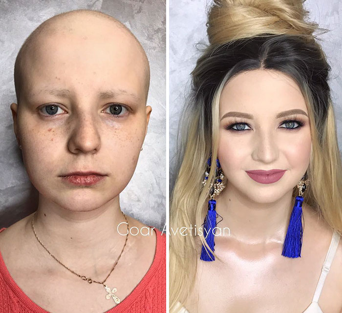 peau blanche femme maquillage avant après cancer chimio